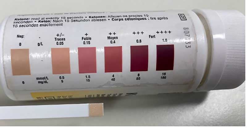 Figure 1. Urine testing can offer an economic alternative to blood testing for large numbers of animals. The optimum balance of sensitivity and specificity is achieved by using trace (+/-) as the diagnostic threshold (sensitivity = 87.6 per cent, specificity = 89.2 per cent). Increasing the threshold to + or ++ increases specificity to more than 95 per cent, but decreases sensitivity (Tatone, Gordon et al, 2016). 