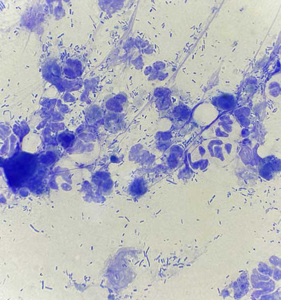 Figure 5. Cytology of the external ear canal shows neutrophilic inflammation and rods extra and intracellular in a dog affected by Pseudomonas aeruginosa.