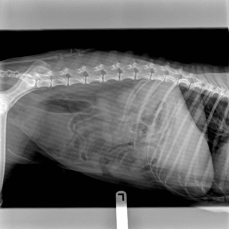 Lateral abdominal radiograph of the patient.