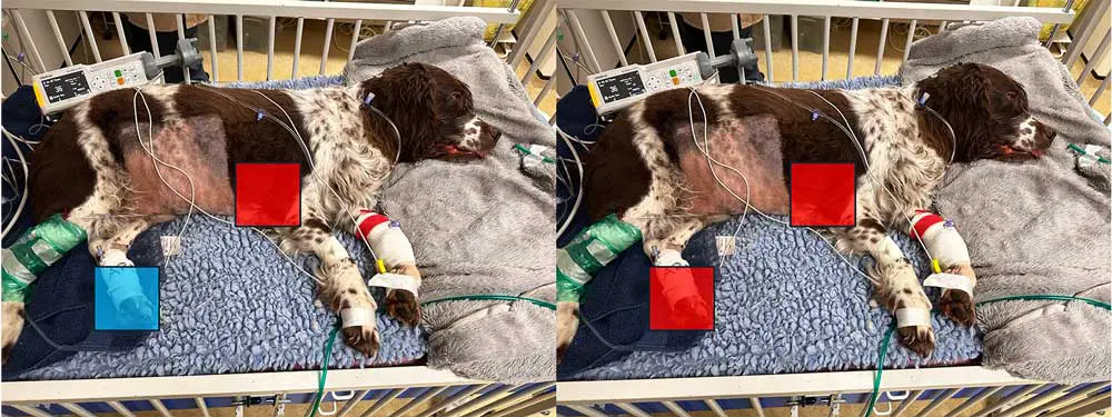 Figure 2. The importance of feeling temperature difference between the core and periphery to evaluate vasoconstriction versus vasodilation. A warm core and cold periphery suggests vasoconstriction, while a warm core and warm periphery suggests vasodilation.