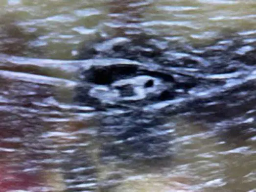 Figure 10. Blood vessels and nerves of the brachial plexus region.