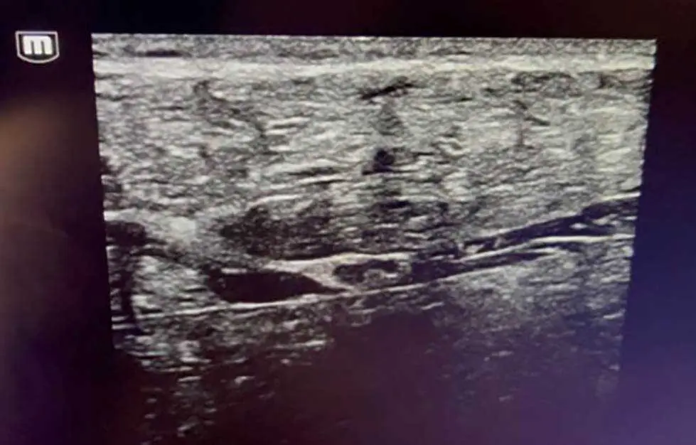 Figure 3. Gain is adjusted to improve contrast between structures in region of interest.