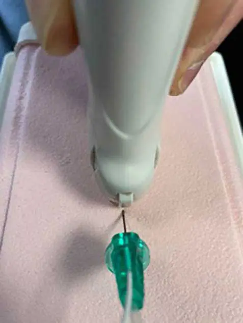 Figure 6. Needle shown in in-plane orientation.