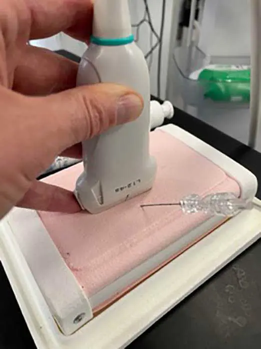 Figure 7. Needle shown in out-of-plane orientation.