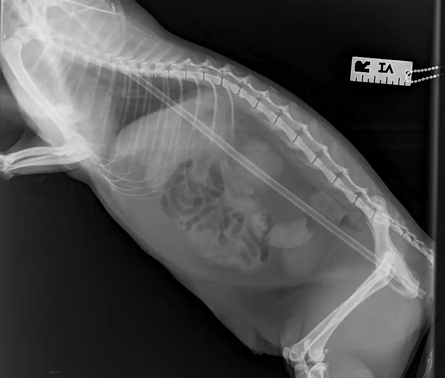 Salvador's x-ray showing the stake.