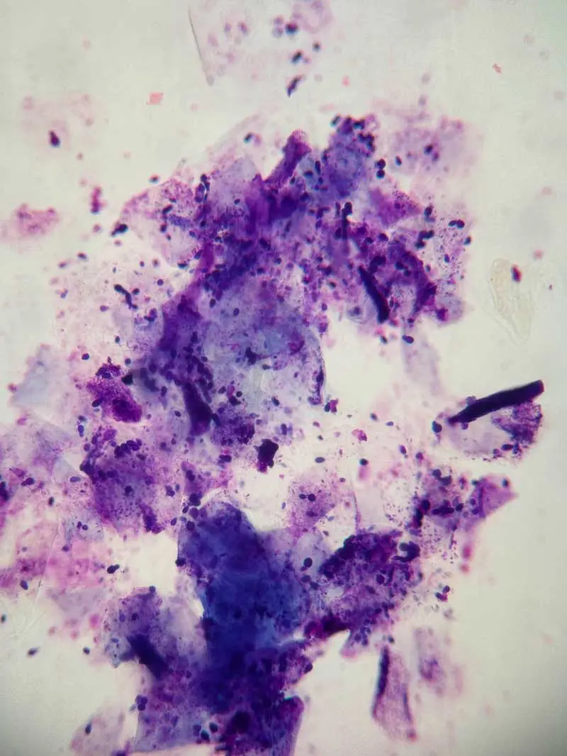 Figure 1. Ear cytology showing clusters of anucleated squamous epithelial cells with attached Malassezia species, free yeasts in the background, and small numbers of mixed bacteria, keratin and cellular debris.