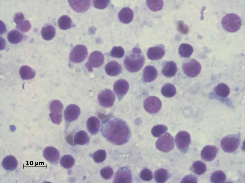 Figure 3. Ehrlichia canis in a lymph node.