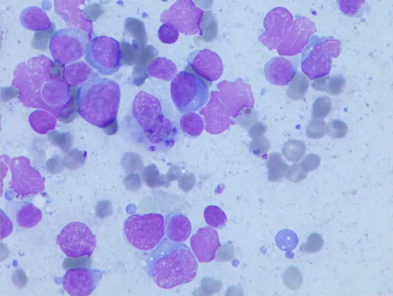 Figure 5. Leishmania species in the lymph node of a dog.