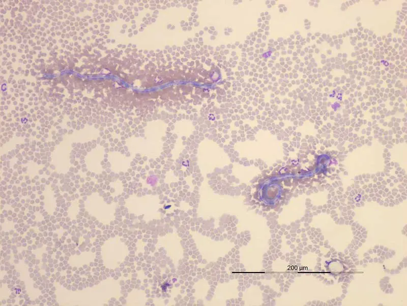 Figure 6. Dirofilaria species in a canine blood smear.