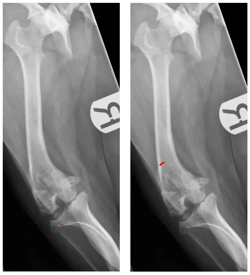 Figure 5. Options for realigning the quadriceps mechanism in dogs with medial patellar luxation in association with distal femoral varus include: 1. Extreme tibial tuberosity transposition (the red arrow in the left-hand image demonstrates the lateralisation that would be required to reposition the quadriceps mechanism over the trochlear groove); 2. Distal femoral varus correction, either a closing ostectomy with a lateral base, as shown by the red lines in the right-hand image, or an opening osteotomy as in Figure 3.