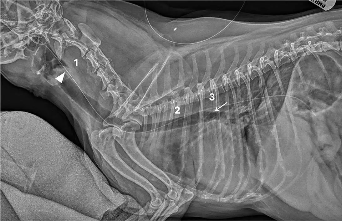 Figure 3. Case three.