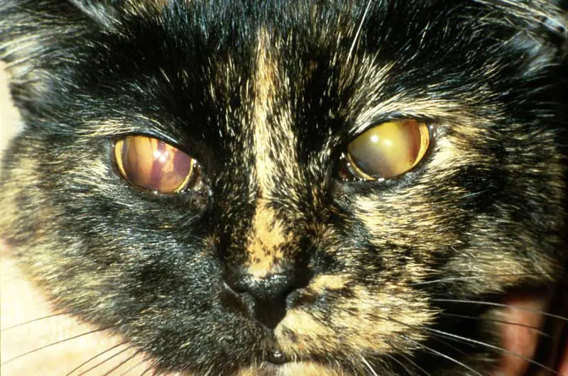 Figure 3. Hyphaema secondary to hypertension and retinal detachment.