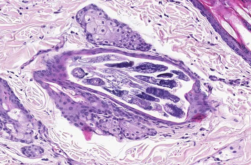 Figure 4. Demodex canis, skin. Multiple intrafollicular mites in longitudinal, transverse, and oblique sections. Haematoxylin and eosin.