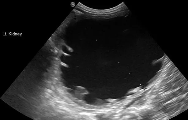 Figure 3. An ultrasound image of a hydronephrotic kidney in a dog with a stenotic ectopic ureterovesicular junction.