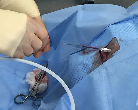Figure 4. A dog undergoing perineal access into the urethra for a urinary intervention.