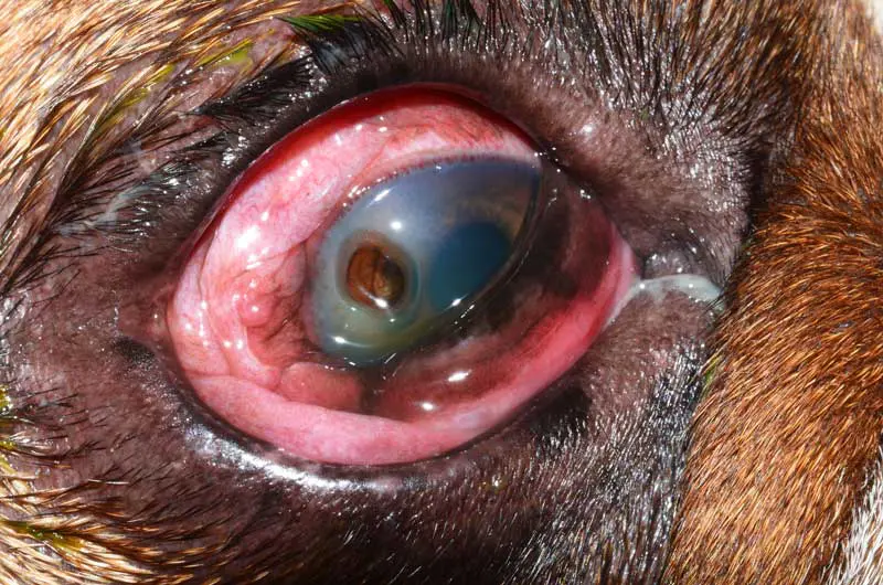 Figure 3. Large corneal perforation.